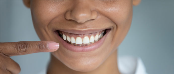 woman smiling and pointing at healthy teeth